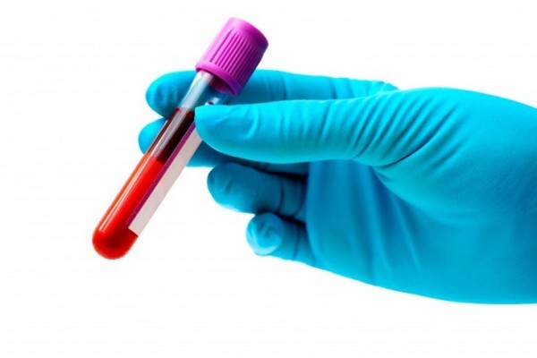 exame-de-sangue-730×487